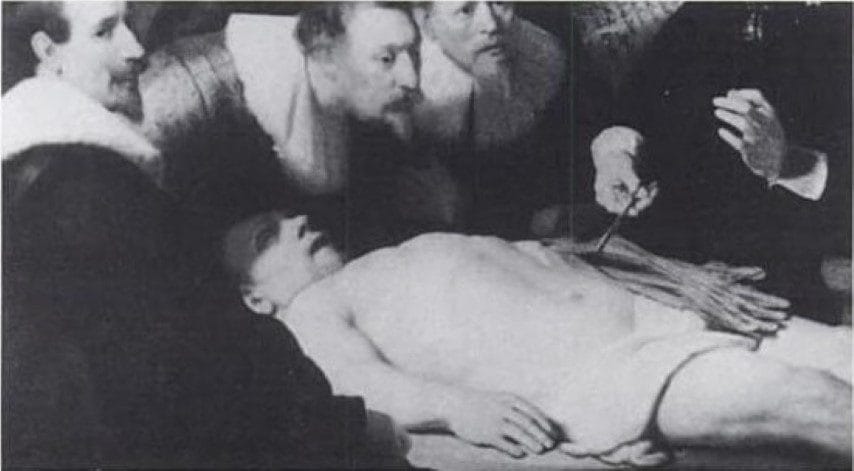 Close-up of The Anatomy Lesson