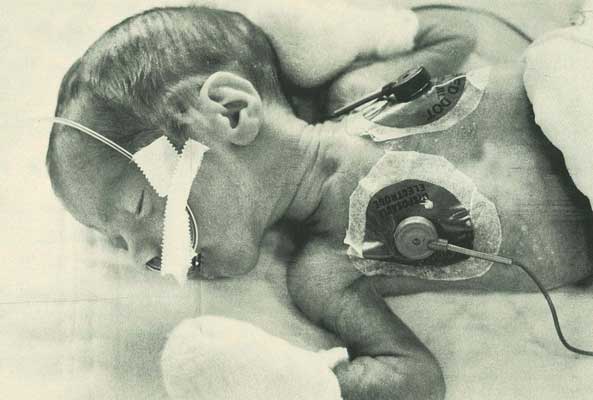 Special Care Nursery