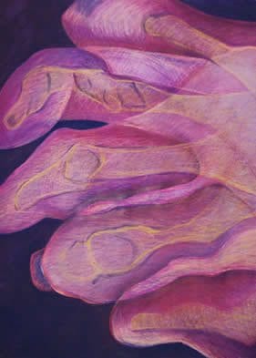 Gout. Purplish pink x-ray of phalanges.