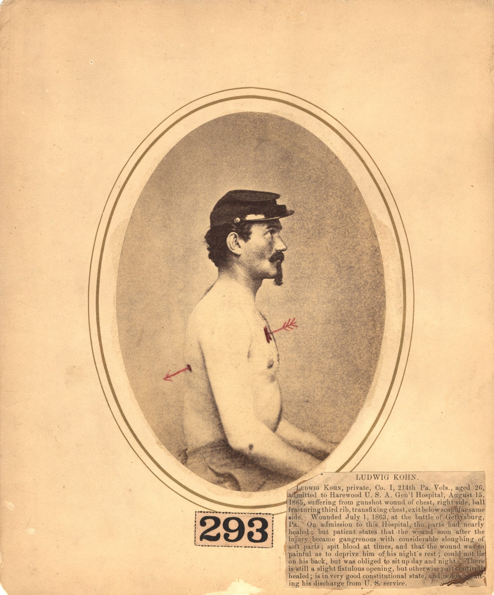 Photograph of Private Ludwig Kohn with hand drawn indicator line