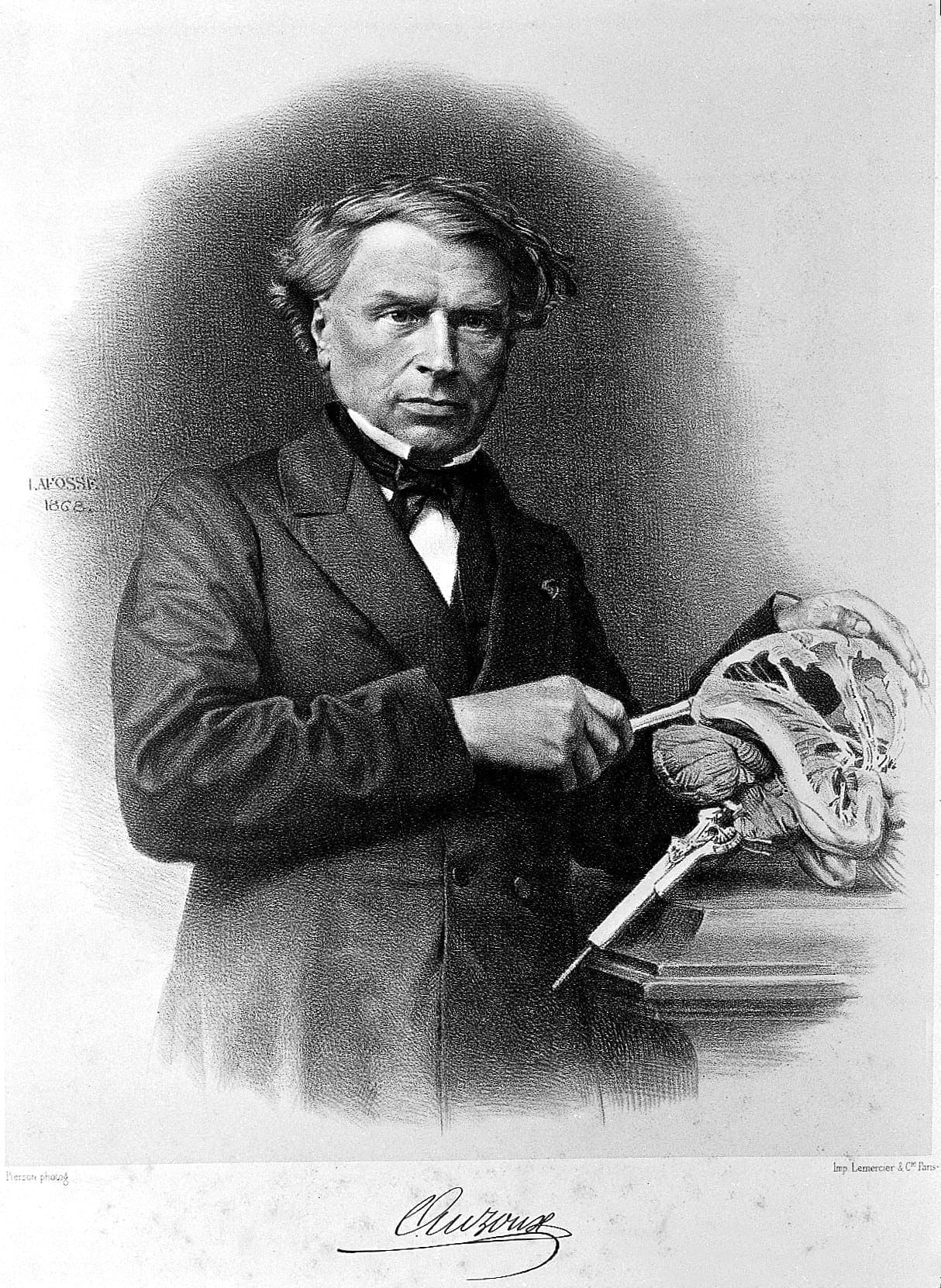 Portrait of Thomas Louis Jerome Auzoux