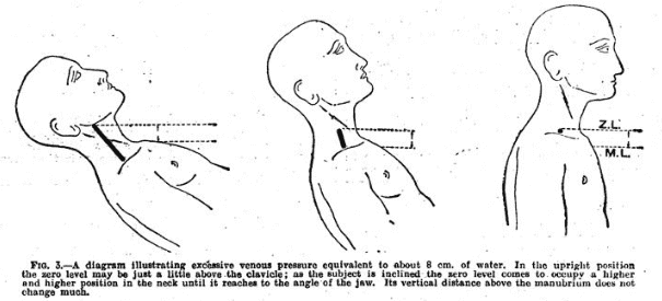 Diagram of the Lewis Method