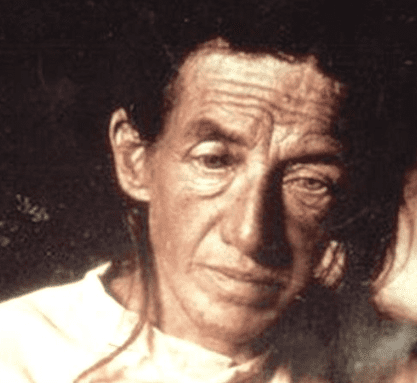 Photo of one of the first recorded cases of a patient with Alzheimer's disease