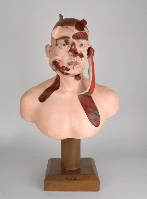 Bust view of male human with different sections of face, chest, and head exposed to show muscle and bone