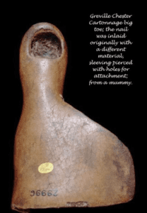 Front of prosthetic foot with only big toe and missing nail. Caption reads "Greville Chester Cartonnage big toe; the nail was inlaid originally with a different material, sleeving pierced with holes for attachment; from a mummy."