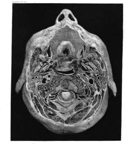 A dissected slice of a human head showing the interior structures including the spine. The nostrils and earlobes are visible.